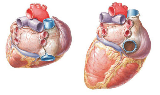 netter-hearts图1.jpg